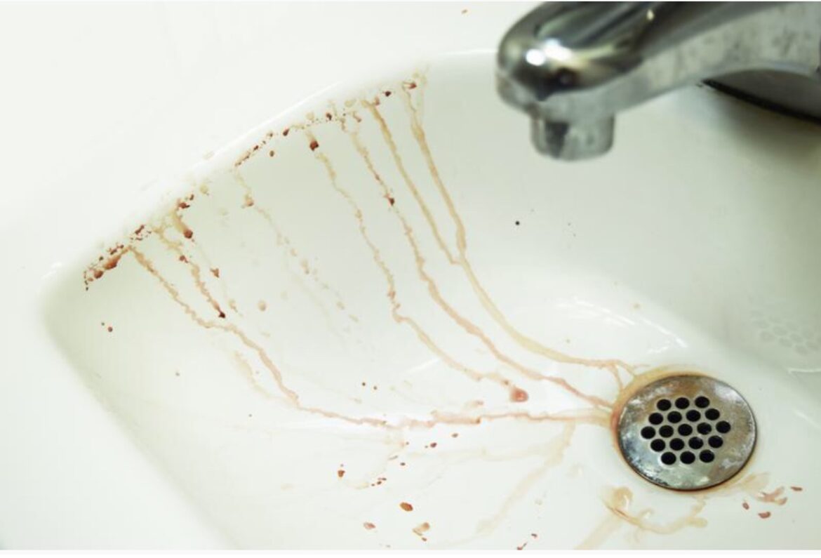 Acqua Sporca dal Rubinetto, il Sindaco:”non utilizzare l’acqua per uso alimentare fino a nuovo avviso”